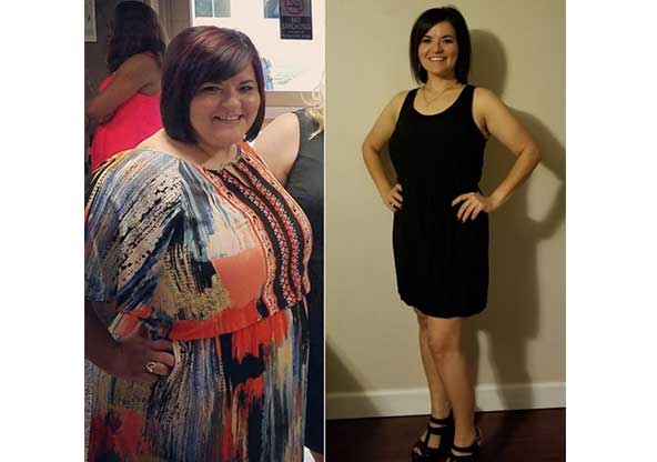 Danielle's before and after weight loss surgery