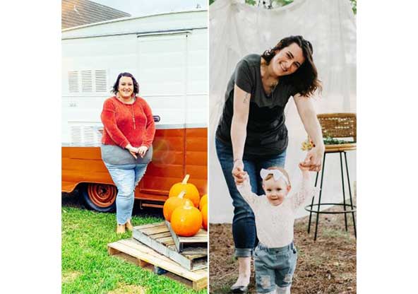 Lindsey's before and after weight loss surgery